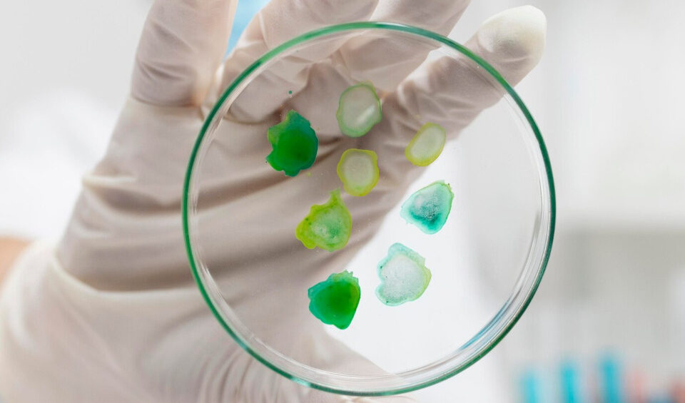 Carotenoids of Spirulina